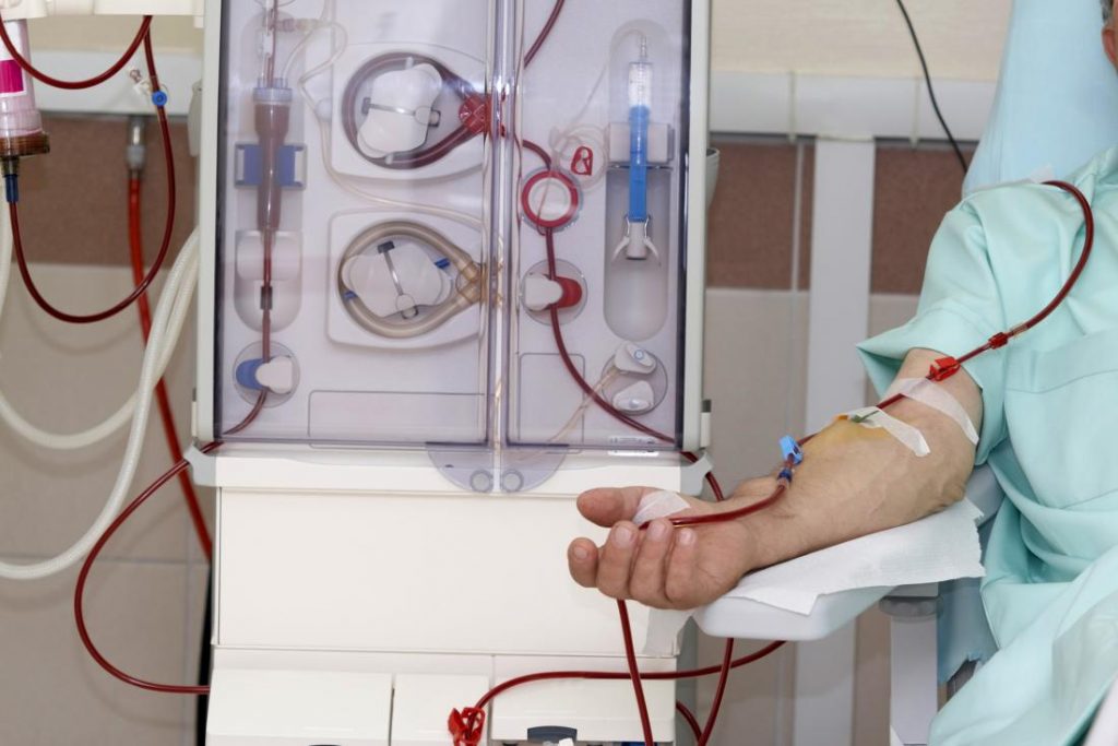 dialysis treatments